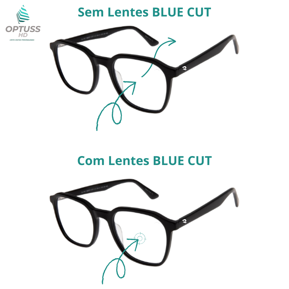 Lente Multifocais OPTUSS HD Basic